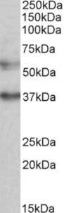 EB10862 (0.5 µg/ml) staining of K562 lysate (35 µg protein in RIPA buffer). Primary incubation was 1 hour. Detected by chemiluminescence.