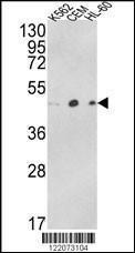 Anti-ACTR3B Rabbit Polyclonal Antibody (AP (Alkaline Phosphatase))