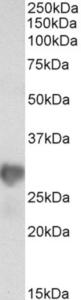 EB12577 (0.3 µg/ml) staining of HeLa lysate (35 µg protein in RIPA buffer). Primary incubation was 1 hour. Detected by chemiluminescence.