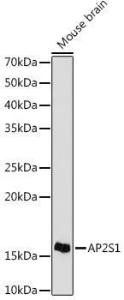 Western blot analysis of extracts of Mouse brain cells, using Anti-AP2S1 Antibody [ARC1500] (A307443) at 1:1,000 dilution