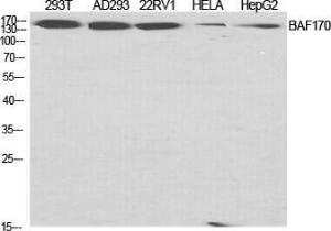 Anti-SMRC2 Rabbit Polyclonal Antibody