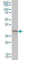 Anti-LFNG Mouse Monoclonal Antibody [clone: 2D10-3C11]