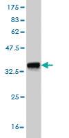 Anti-EXO1 Mouse Monoclonal Antibody [clone: 1G12]