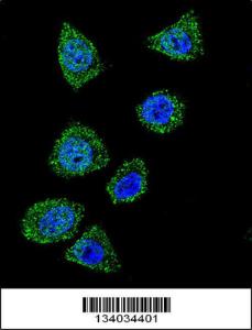 Anti-TOP1 Rabbit Polyclonal Antibody (AP (Alkaline Phosphatase))