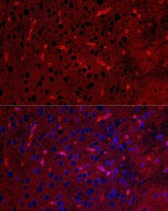 Immunofluorescence analysis of rat brain using Anti-Aquaporin 4 Antibody [ARC54345] (A80530) at a dilution of 1:100 (40x lens). DAPI was used to stain the cell nuclei (blue).