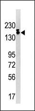 Anti-SETDB1 Rabbit Polyclonal Antibody