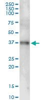 Anti-POMC Polyclonal Antibody Pair