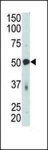 Anti-PDK4 Rabbit Polyclonal Antibody