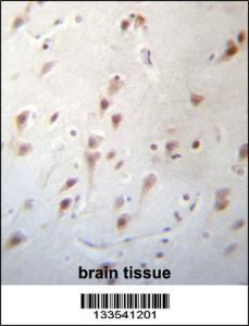 Anti-FOXJ3 Rabbit Polyclonal Antibody