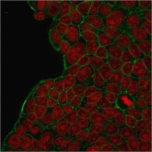 Anti-HER2 antibody