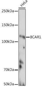 Anti-BCAR1 antibody