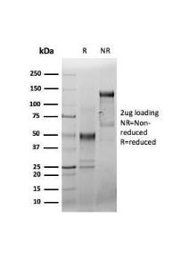 SDS-PAGE analysis of Anti-CD44 Antibody [HCAM/6459R] under non-reduced and reduced conditions; showing intact IgG and intact heavy and light chains, respectively. SDS-PAGE analysis confirms the integrity and purity of the antibody