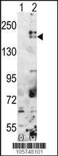 Anti-SETDB1 Rabbit Polyclonal Antibody