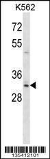 Anti-HOXB8 Rabbit Polyclonal Antibody (AP (Alkaline Phosphatase))