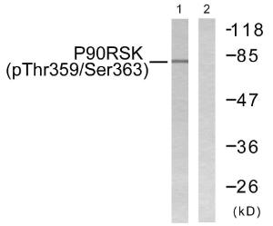 Western blot analysis of lysates from 293 cells treated with PMA 125ng/ml 30' using Anti-p90 RSK (phospho Thr359+Ser363) Antibody. The right hand lane represents a negative control, where the antibody is blocked by the immunising peptide.