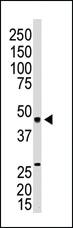 Anti-S1PR3 Rabbit Polyclonal Antibody