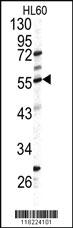 Anti-GPT Rabbit Polyclonal Antibody