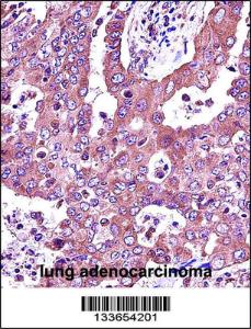 Anti-JAK2 Rabbit Polyclonal Antibody (FITC (Fluorescein Isothiocyanate))