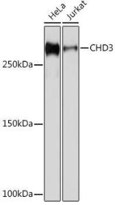 Anti-CHD3 Rabbit Monoclonal Antibody [clone: ARC1975]