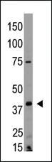 Anti-LPAR2 Rabbit Polyclonal Antibody