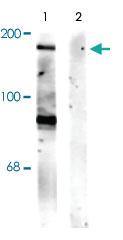 Anti-GRIN2B Rabbit Polyclonal Antibody