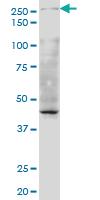 Anti-TAF1 Mouse Monoclonal Antibody [clone: 1G9]