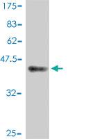 Anti-ERCC3 Mouse Polyclonal Antibody