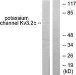 Anti-KCNC2 Rabbit Polyclonal Antibody