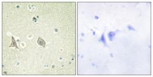 Immunohistochemical analysis of paraffin-embedded human brain using Anti-M-CSF Receptor (phospho Tyr723) Antibody. The right hand panel represents a negative control, where the Antibody was pre-incubated with the immunising peptide