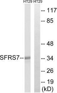 Western blot analysis of lysates from HT-29 cells using Anti-SFRS7 Antibody. The right hand lane represents a negative control, where the antibody is blocked by the immunising peptide