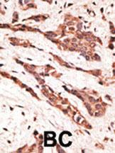 Anti-LPAR2 Rabbit Polyclonal Antibody