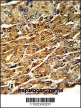 Anti-GPT Rabbit Polyclonal Antibody