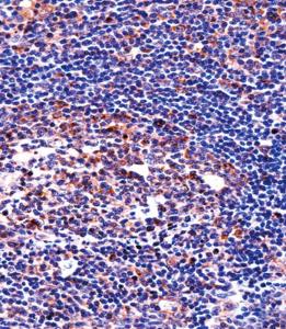 Anti-QPRT Rabbit Polyclonal Antibody (HRP (Horseradish Peroxidase))