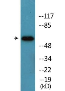 Western blot analysis of Jurkat cells treated with TNF using Anti-HS1 (phospho Tyr397) Antibody