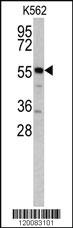 Anti-GPT Rabbit Polyclonal Antibody