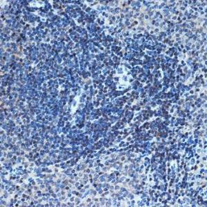 Anti-CHD3 Rabbit Monoclonal Antibody [clone: ARC1975]