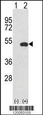 Anti-SMC1B Rabbit Polyclonal Antibody