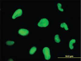 Anti-ZNF207 Mouse Monoclonal Antibody [clone: 5G6]