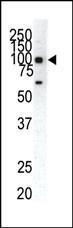 Anti-EPHA1 Rabbit Polyclonal Antibody