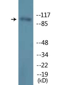 Anti-M-CSF Receptor