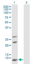 Anti-AKR1C8P Mouse Polyclonal Antibody