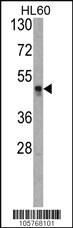 Anti-HAT1 Rabbit Polyclonal Antibody