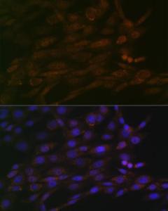 Anti-CHD3 Rabbit Monoclonal Antibody [clone: ARC1975]