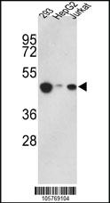 Anti-HAT1 Rabbit Polyclonal Antibody