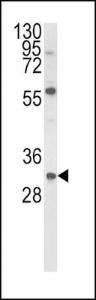 Anti-Glial Derived Neurotrophic Factor Rabbit Polyclonal Antibody (AP (Alkaline Phosphatase))