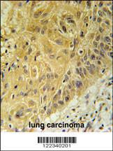 Anti-WNT5A Rabbit Polyclonal Antibody (FITC (Fluorescein Isothiocyanate))