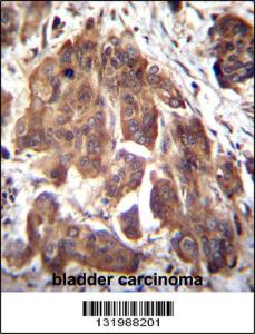 Anti-GLMN Rabbit Polyclonal Antibody (Biotin)