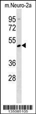 Anti-AGER Rabbit Polyclonal Antibody (PE (Phycoerythrin))