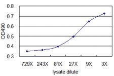 Anti-TAGLN Mouse Monoclonal Antibody (Biotin)