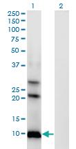 Anti-AKR1C8P Mouse Monoclonal Antibody [clone: 4G8]